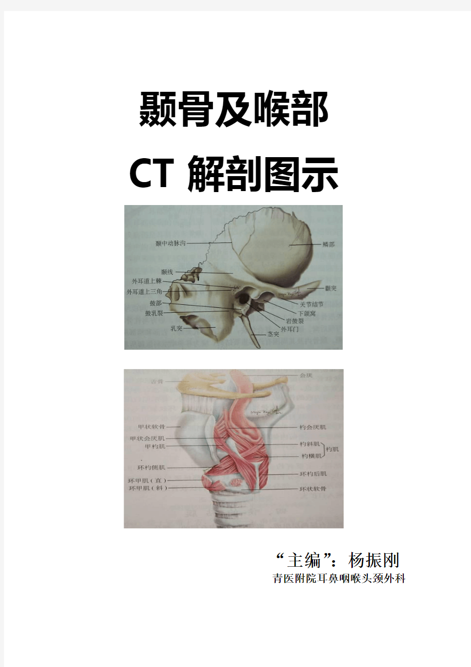 颞骨及喉部CT解剖详解