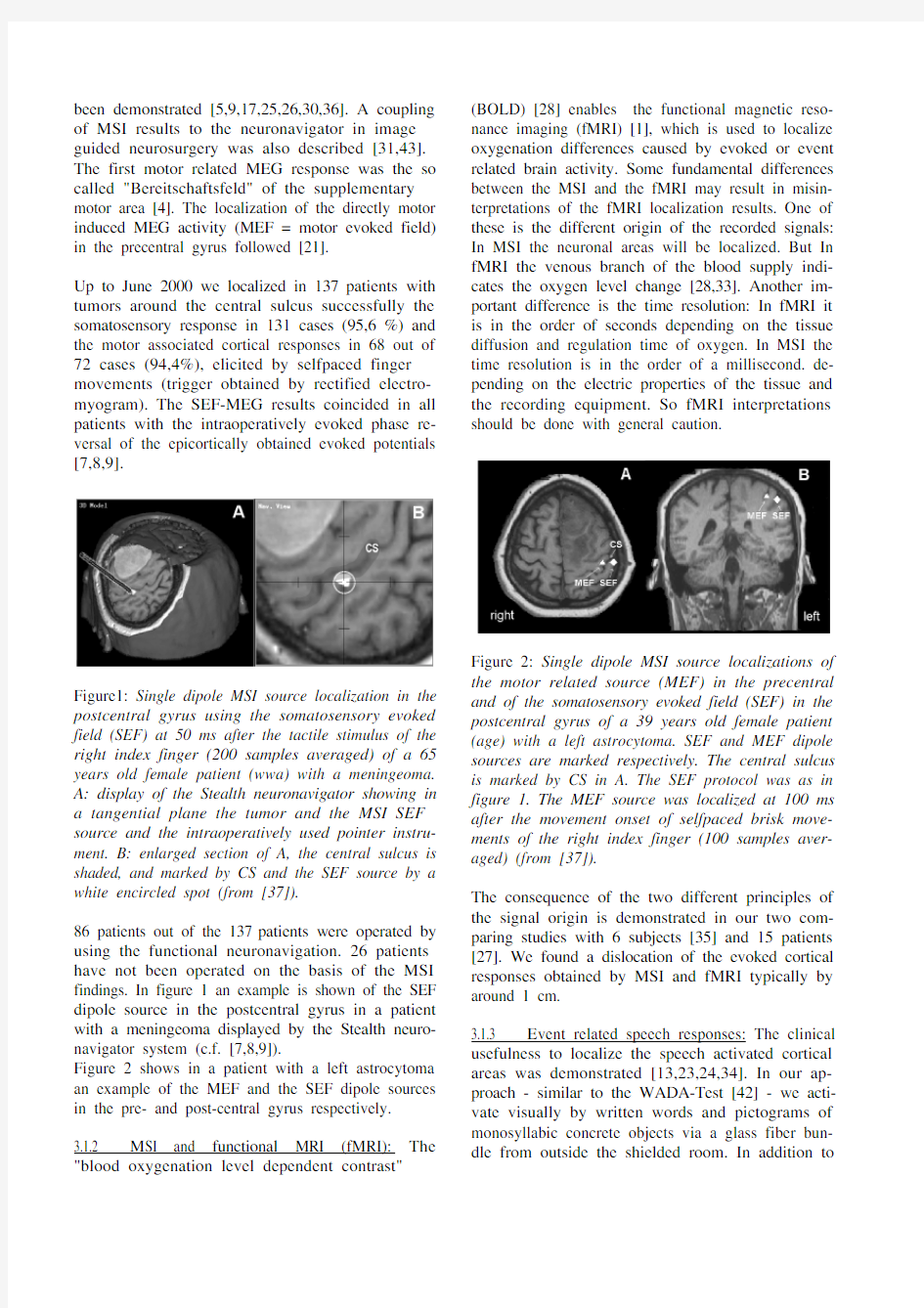 The clinical use of MEG activity associated with brain lesions