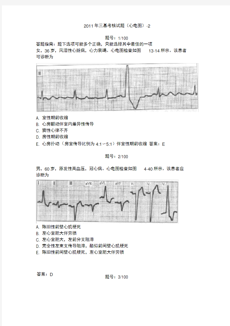 三基考核试题答案(心电图)