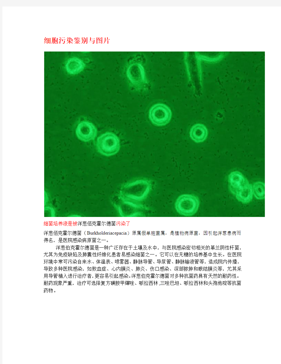 细胞培养中污染的图片