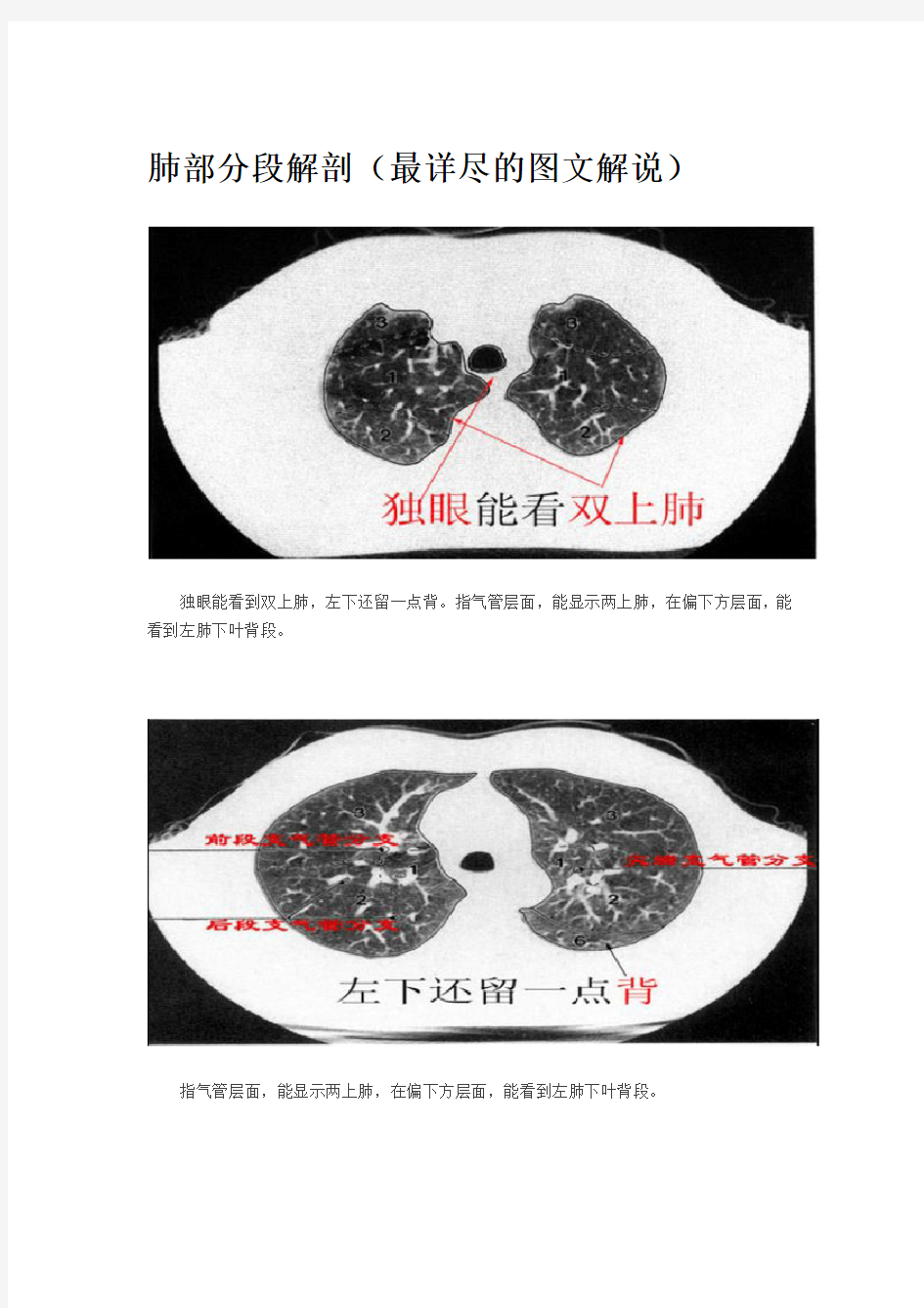 肺部分段解剖