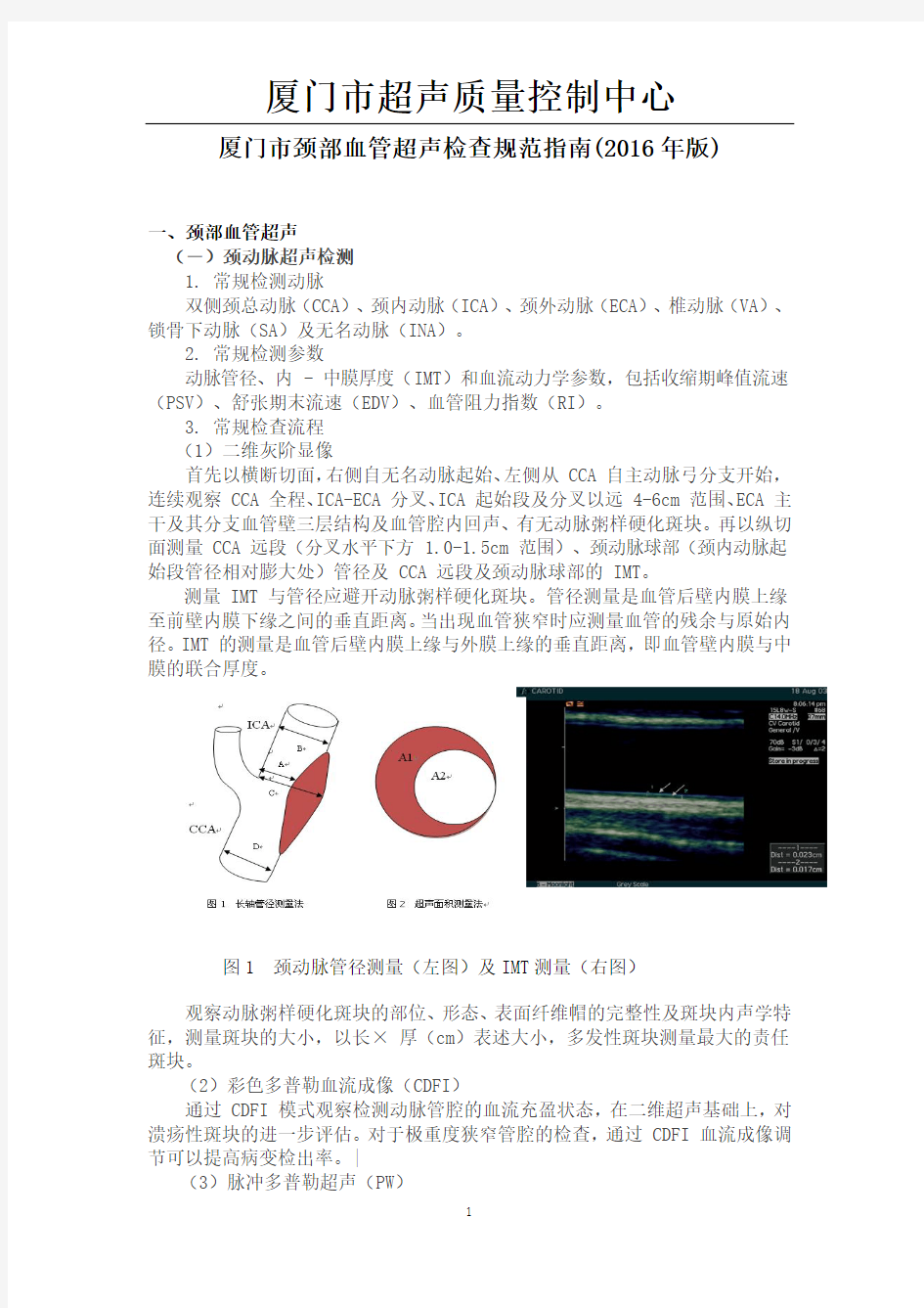 颈部血管超声检查规范指南