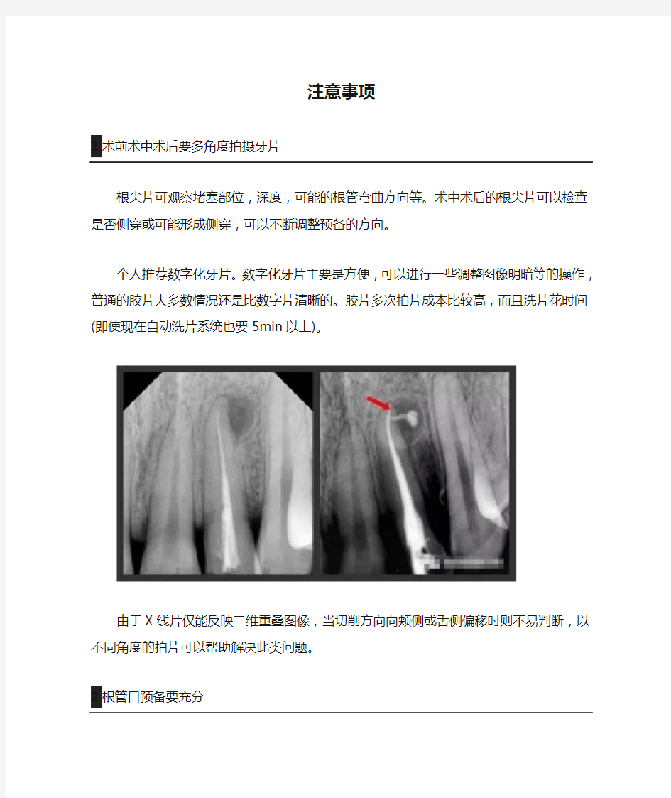 牙医必知的11个根管治疗术前、术中、术后的注意事项!