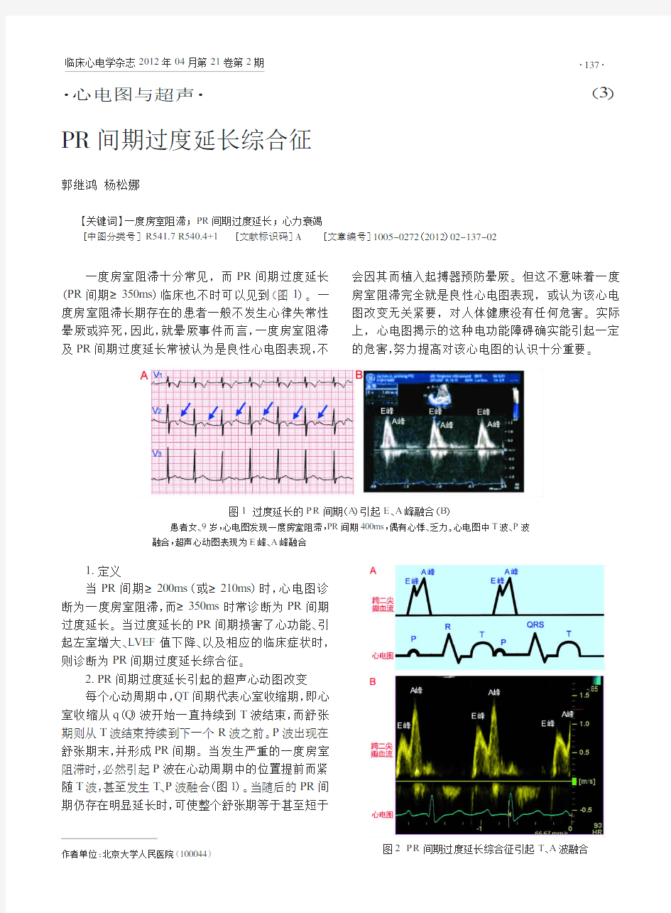 PR间期过度延长综合征_郭继鸿