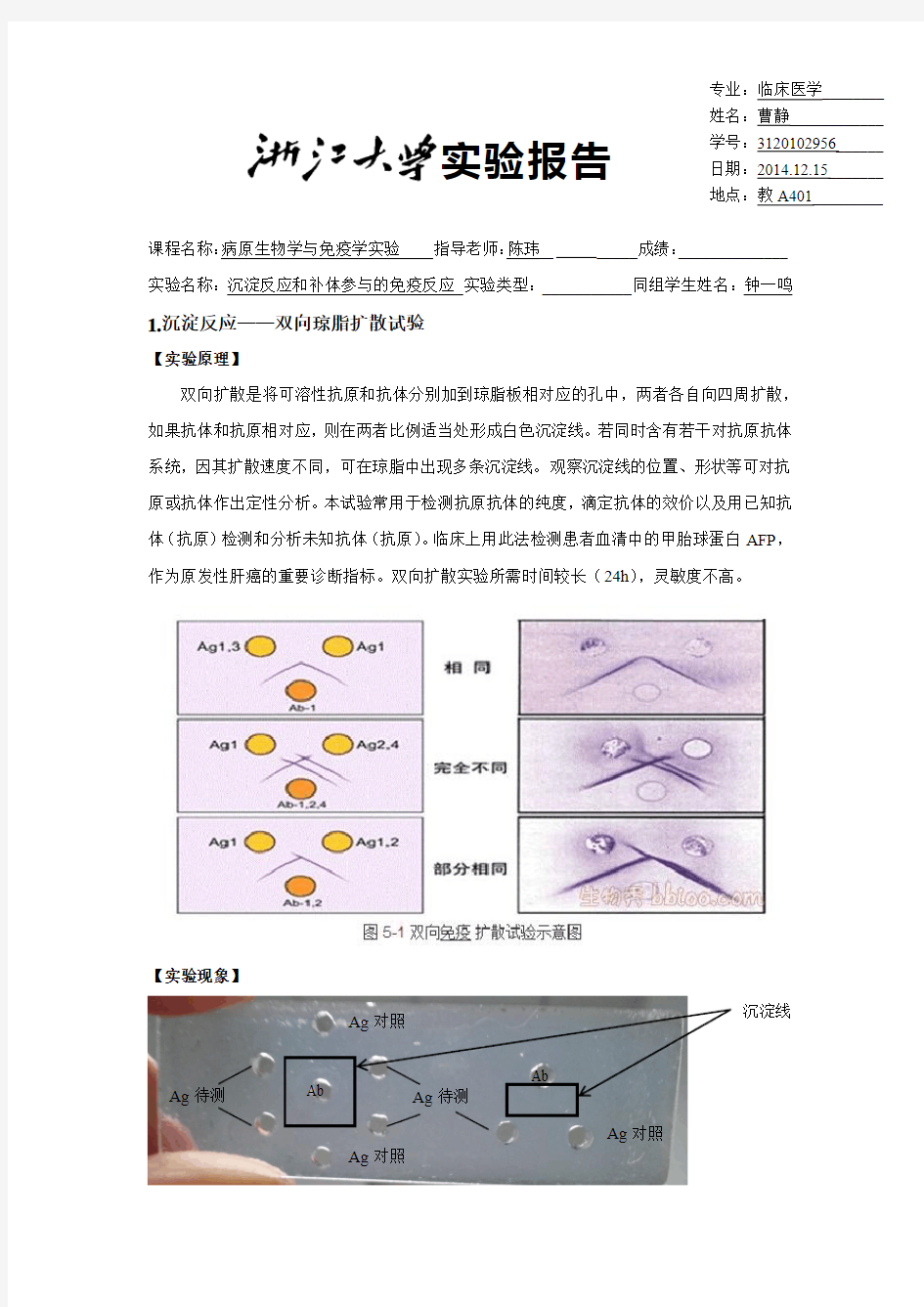 免疫学——沉淀反应