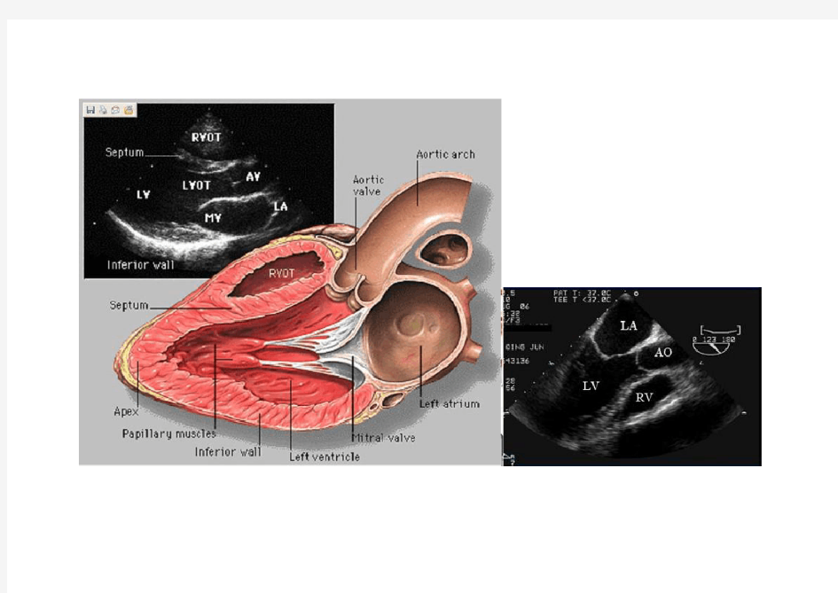 经典心脏超声与食管超声心动图及解剖的比较