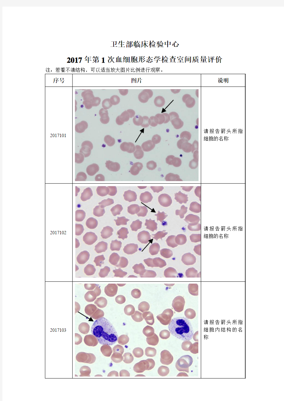 2017年第1次血细胞形态学检查室间质量评