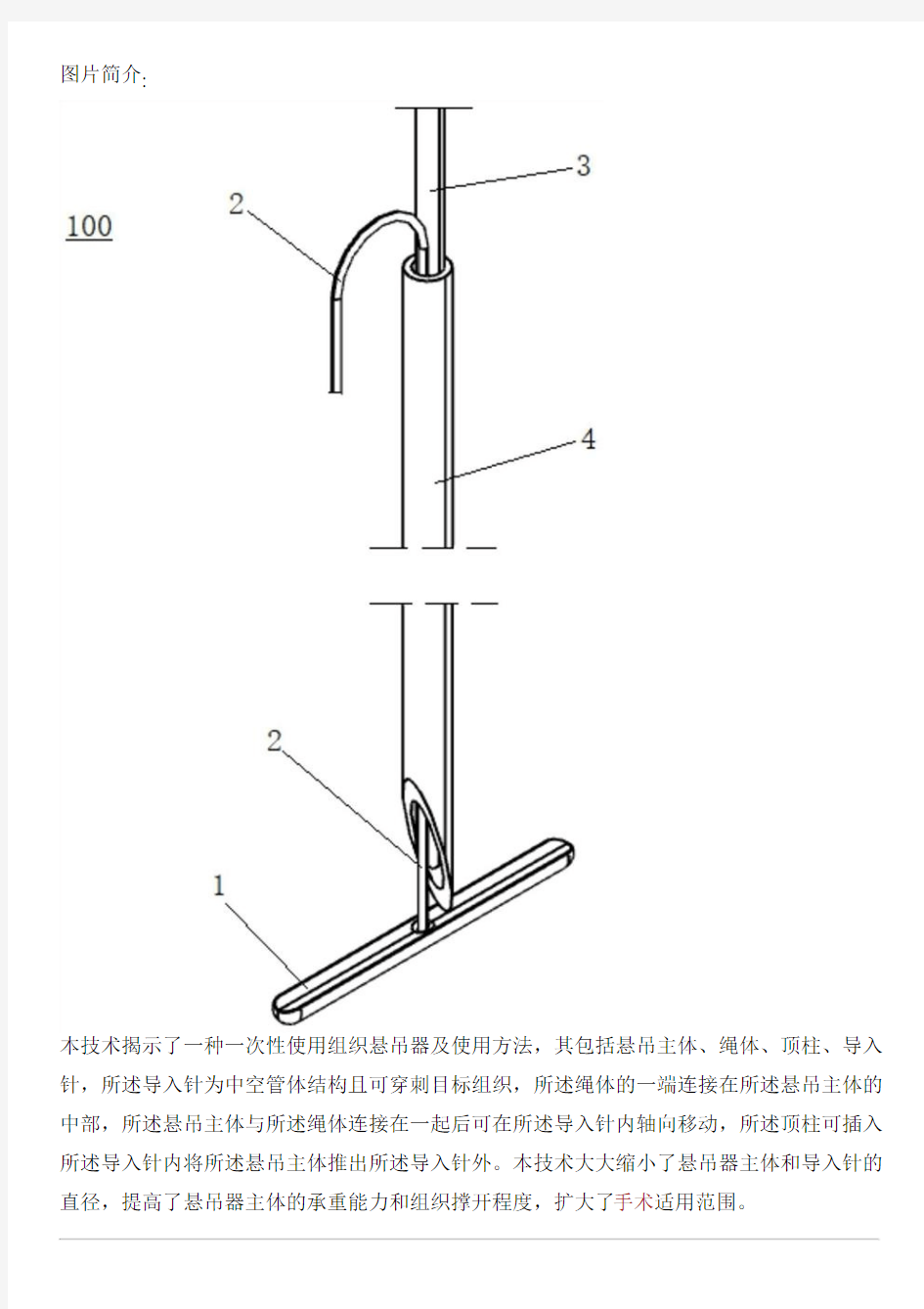 一次性使用组织悬吊器及使用方法与相关技术