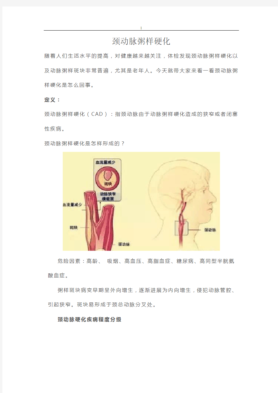 颈动脉粥样硬化