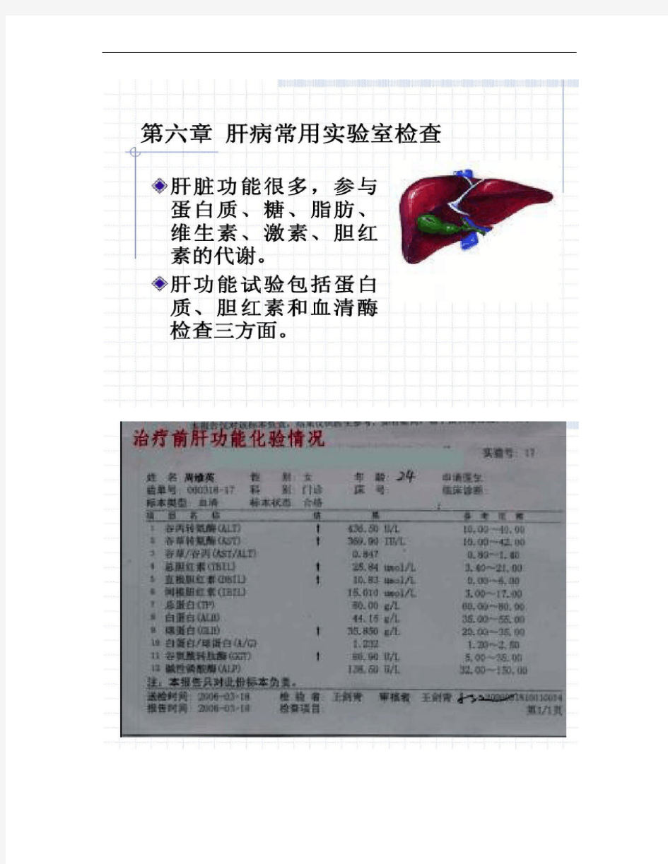 第六章  肝病常用实验室检查