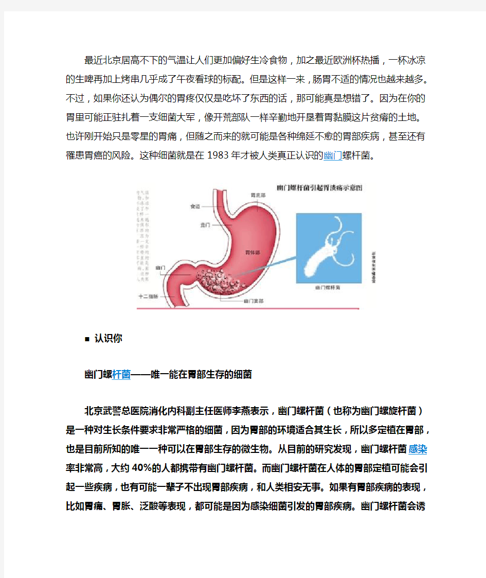 幽门螺杆菌——唯一能在胃部生存的细菌