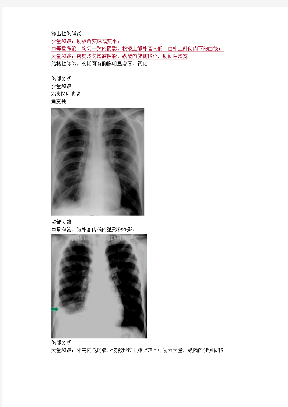 2014内科主治医师考试专业实践结核3结核性胸膜炎