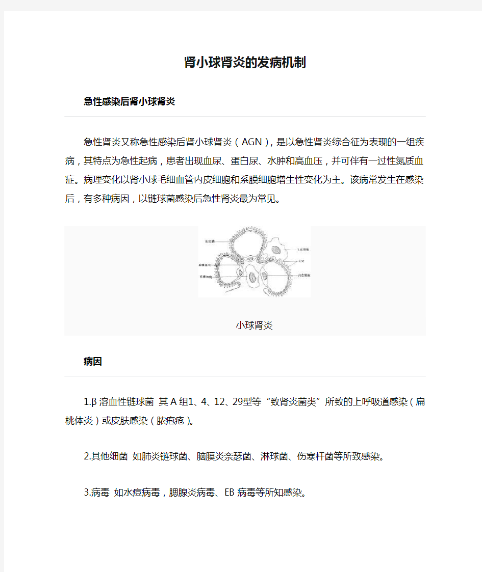 肾小球肾炎的发病机制