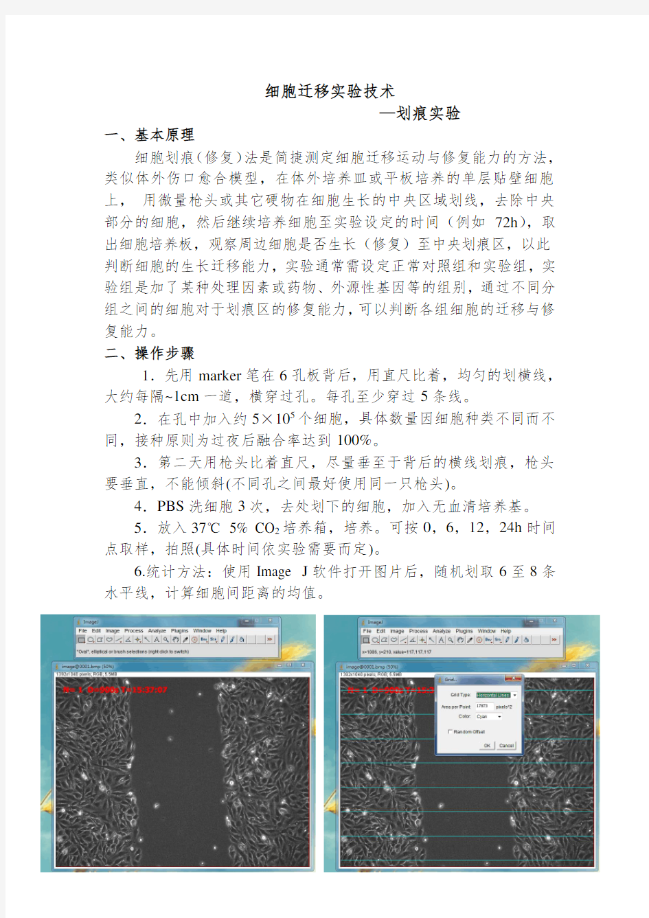 细胞迁移-划痕实验 (1)