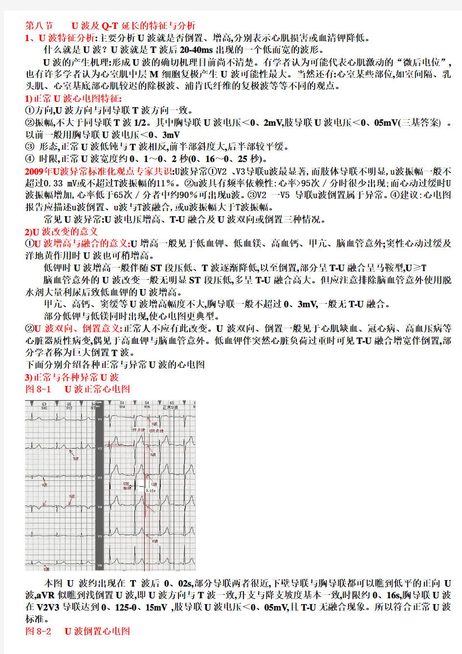 另类心电图学讲义11