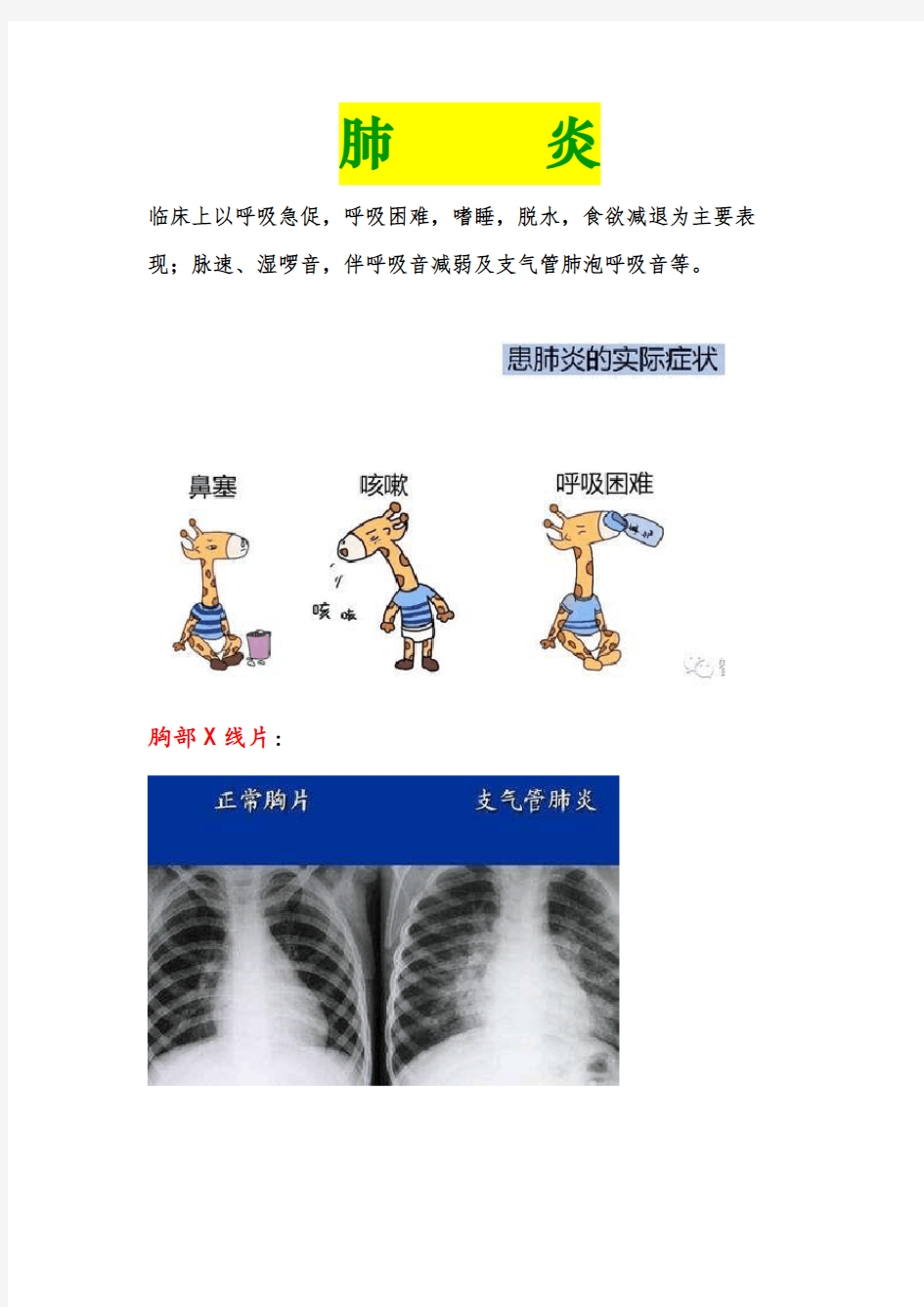 肺炎相关知识