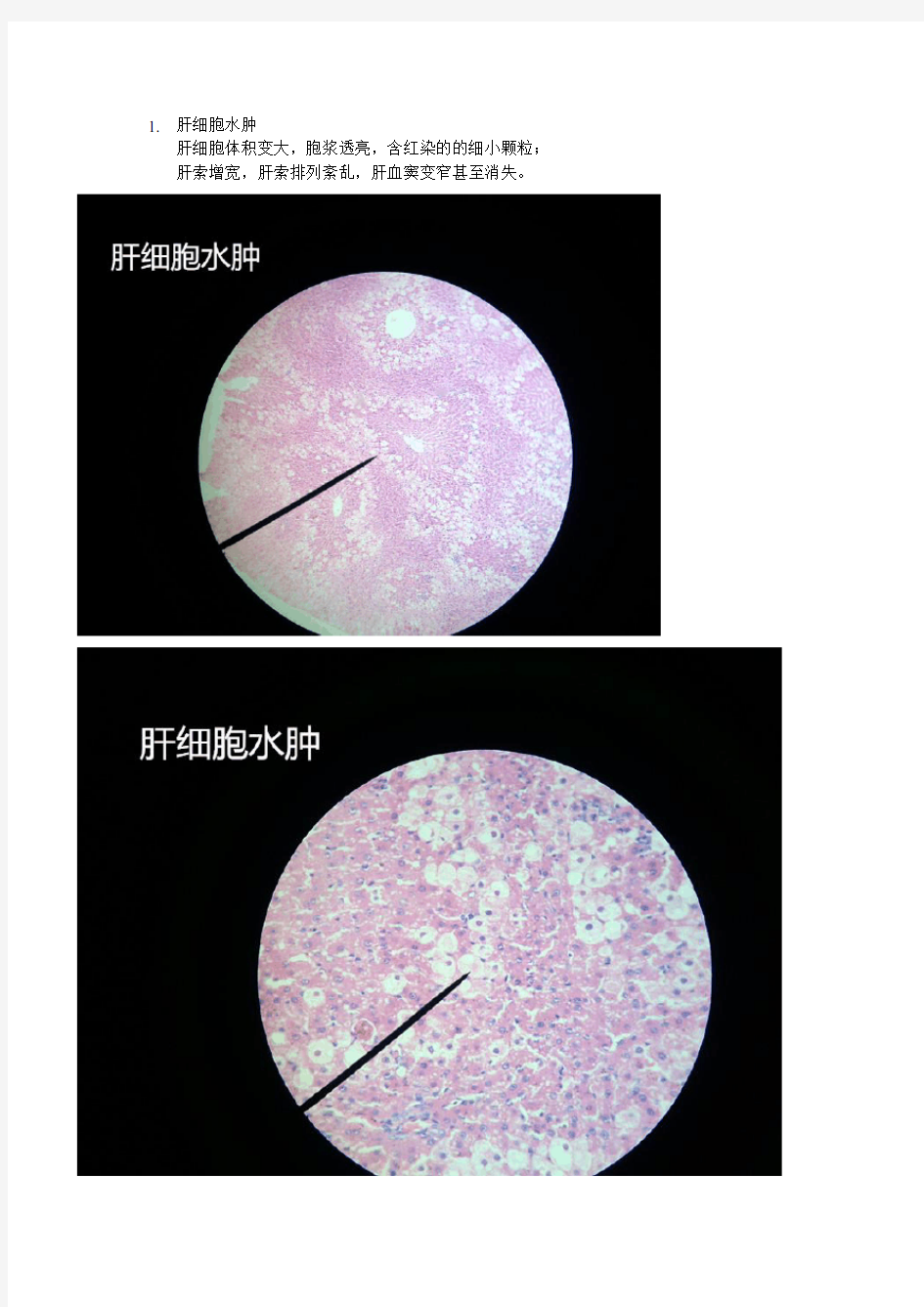 病理学 镜下切片