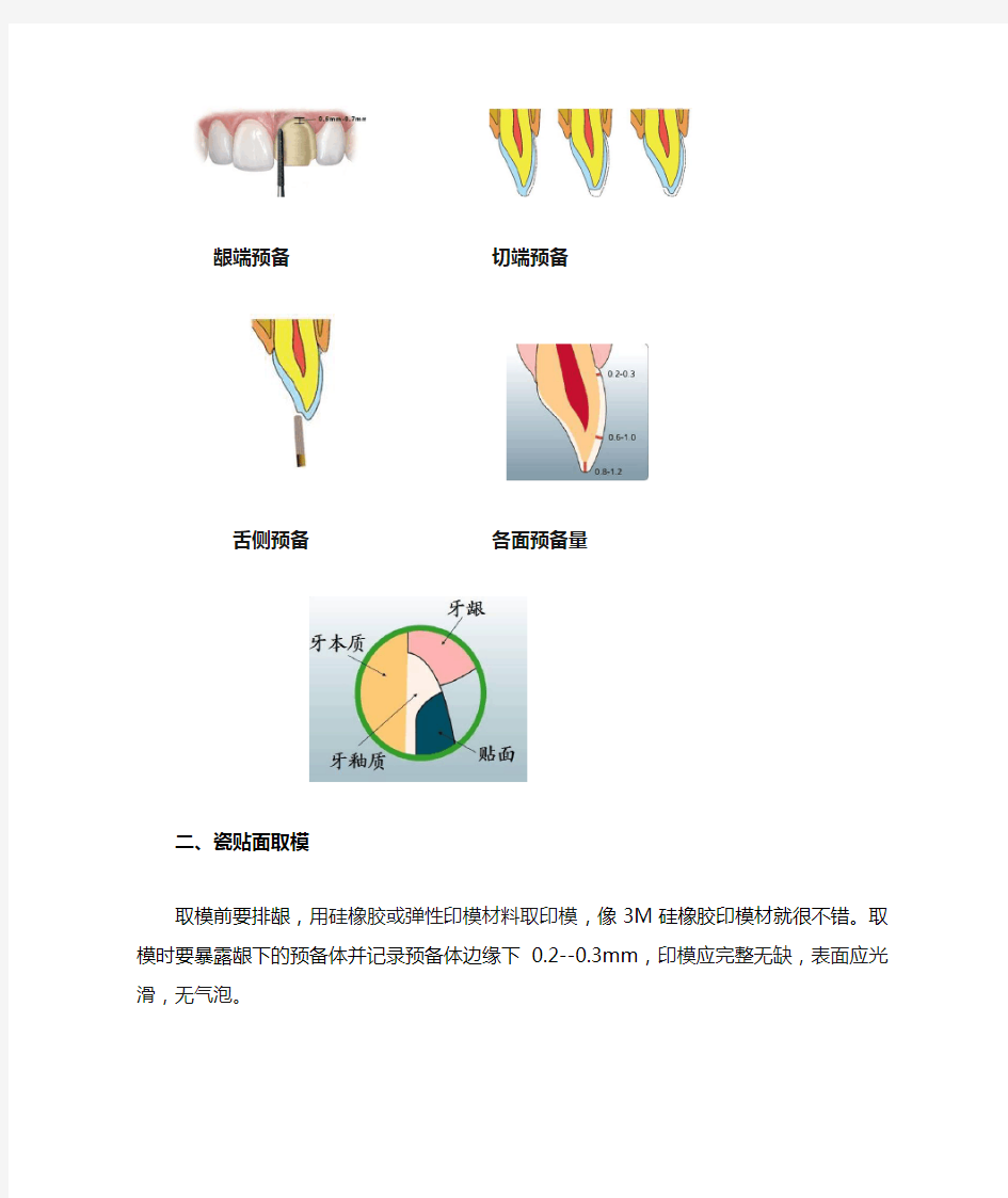 瓷贴面修复的操作事项