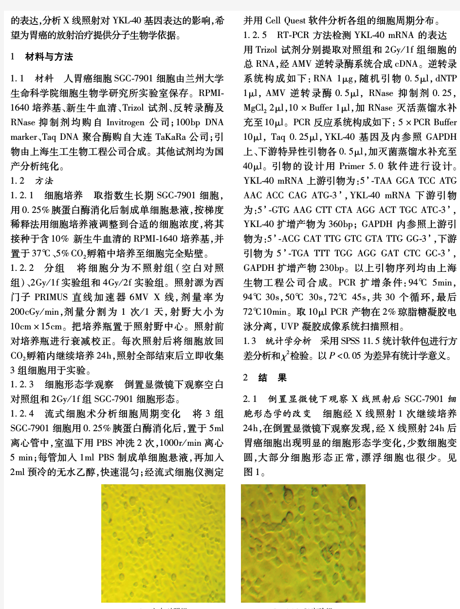 X 线照射诱导人胃癌SGC-7901 细胞生物特性改变以及YKL-40 基因表达变化