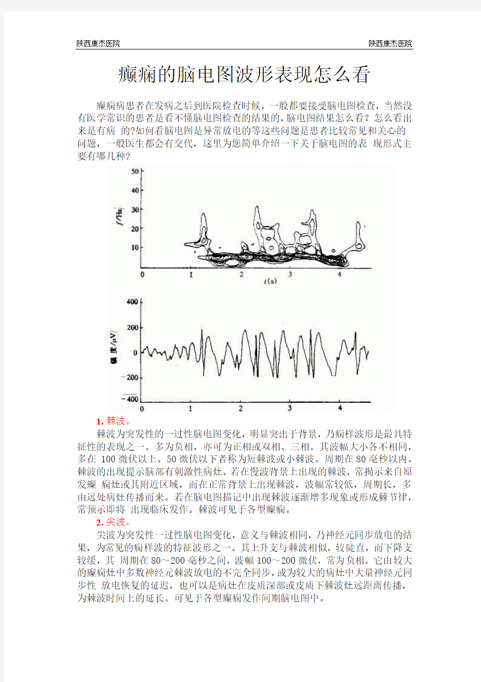 癫痫的脑电图波形表现怎么看