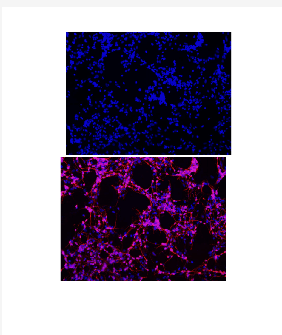 小鼠皮层神经元免疫荧光鉴定图片