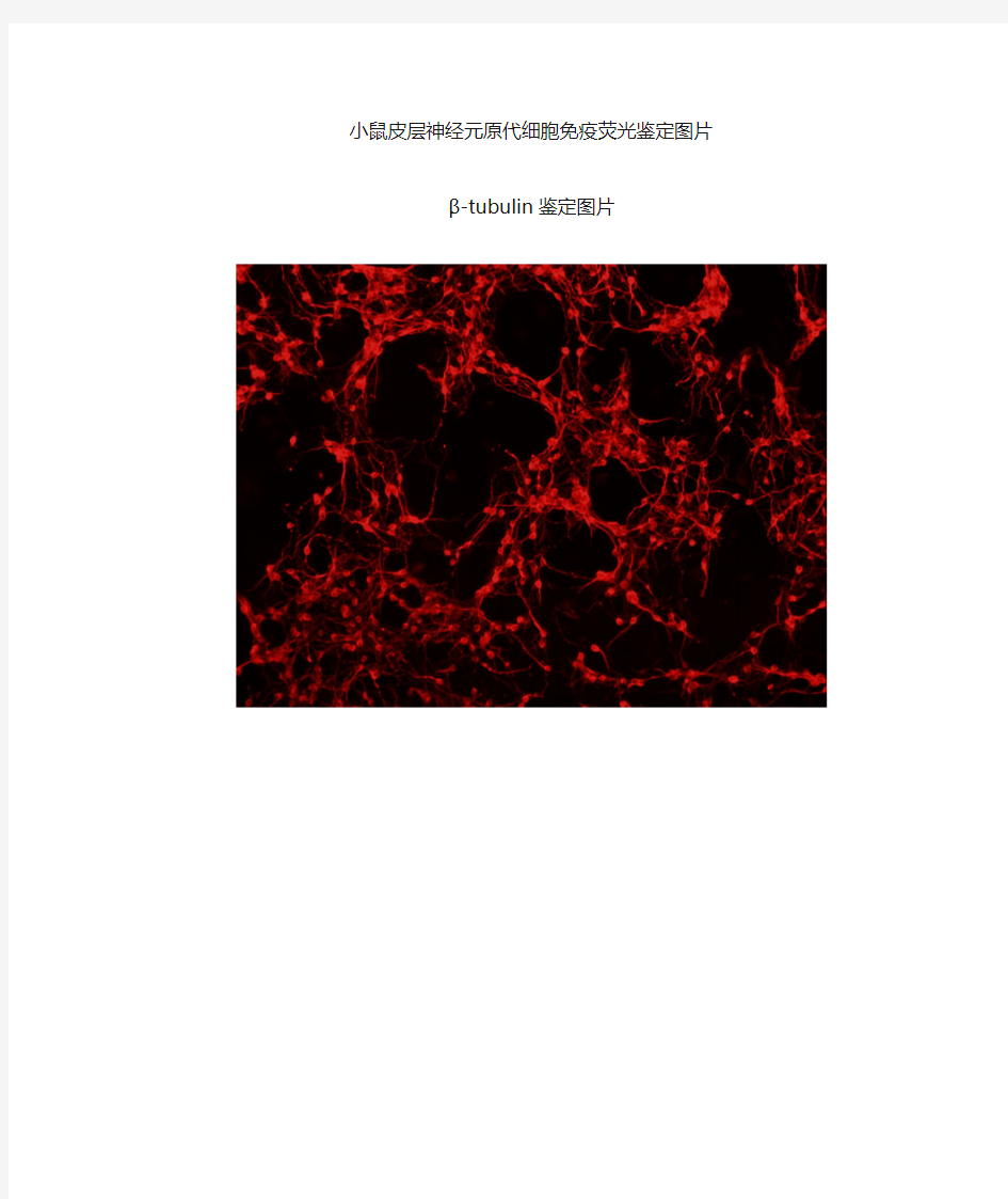 小鼠皮层神经元免疫荧光鉴定图片