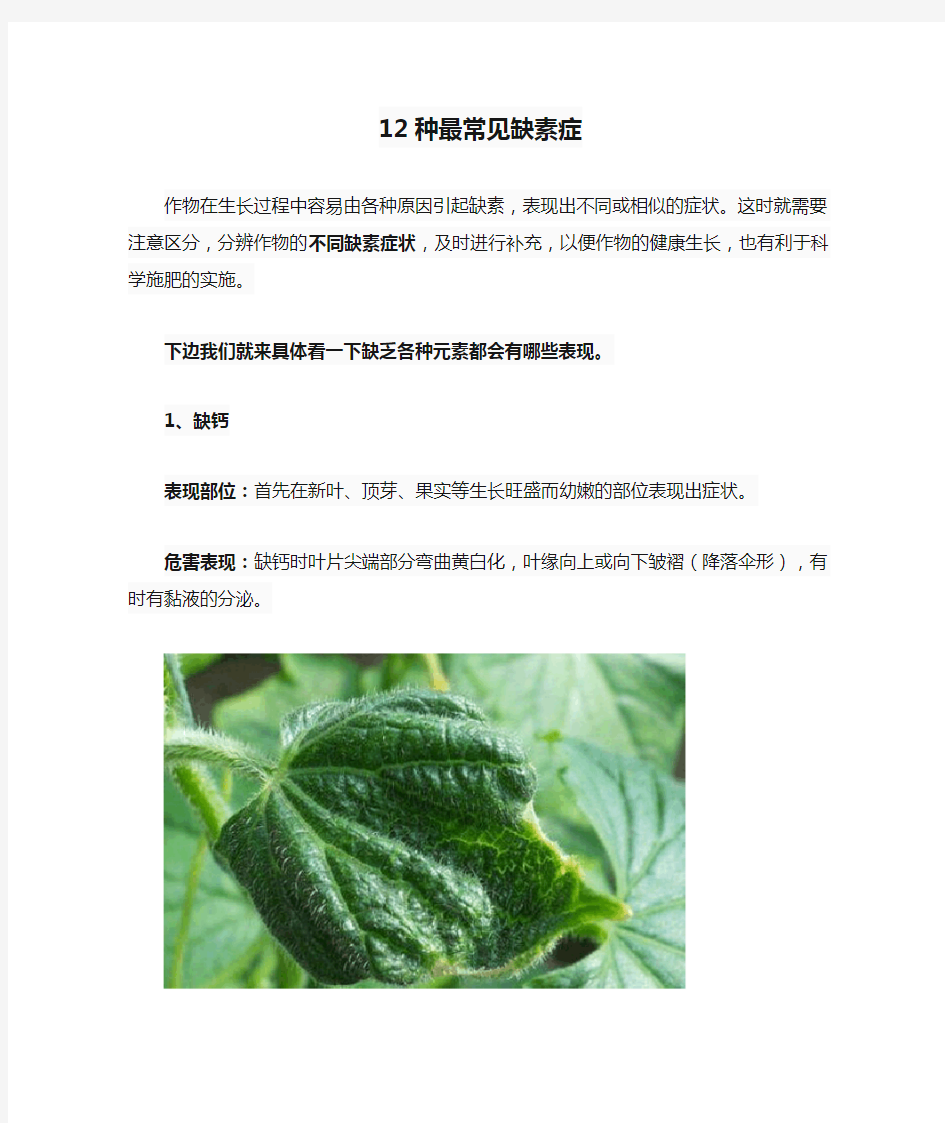 12种最常见缺素症