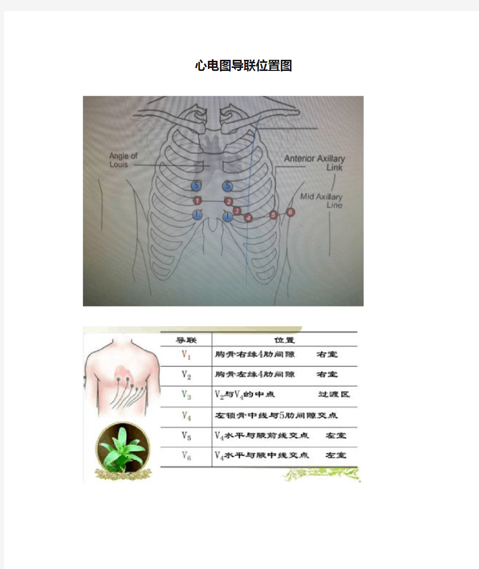 心电图导联位置图