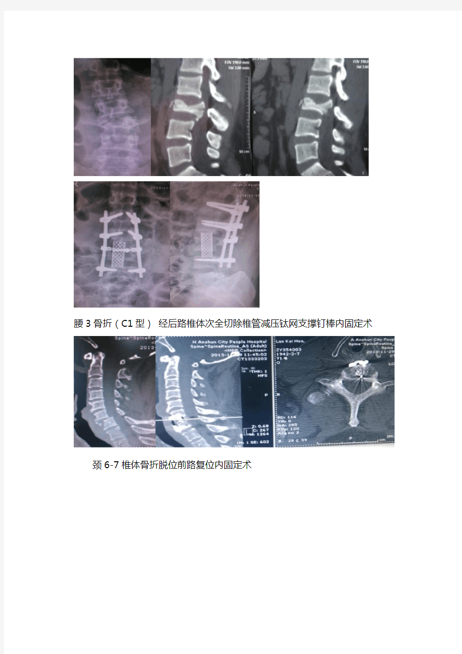 脊柱外科发展现状