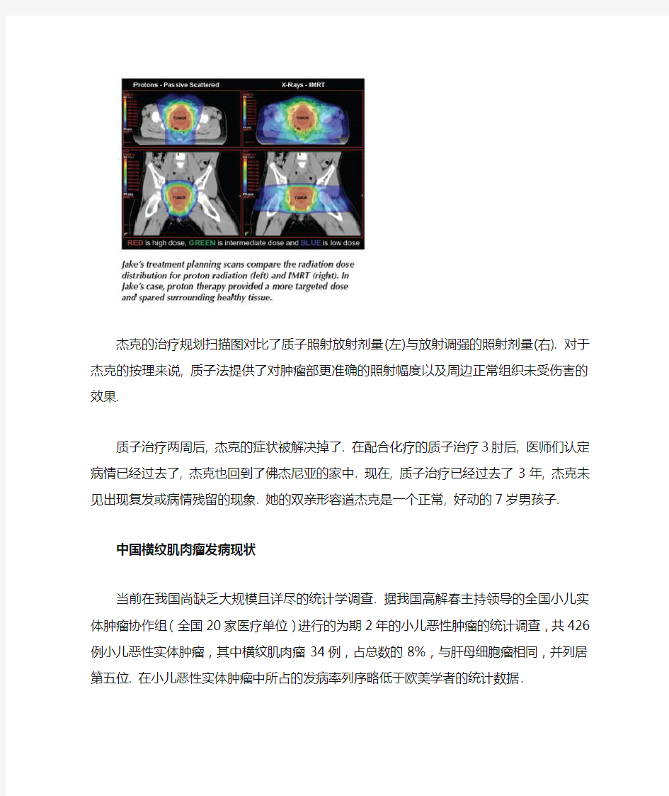 儿童横纹肌肉瘤质子治疗案例