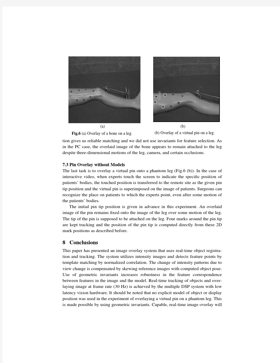 Automatic Registration Method for Frameless Stereotaxy, Image Guided Surgery, and