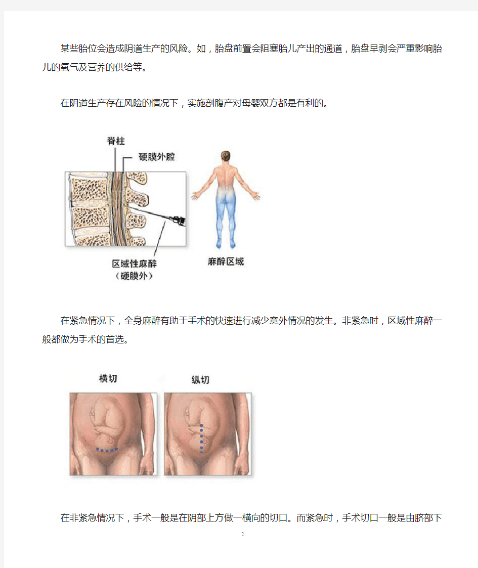 剖腹产手术过程详细图解
