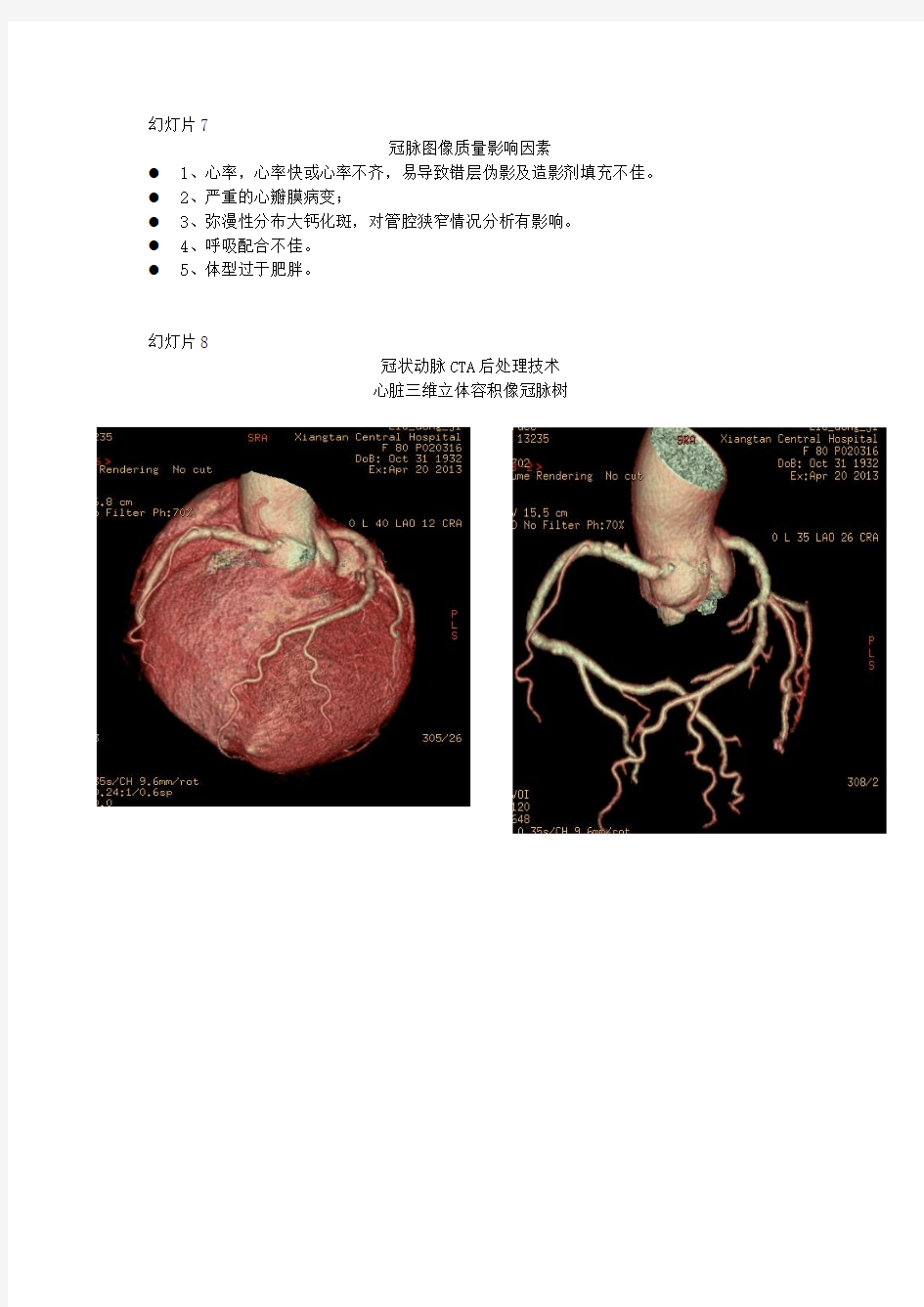 1、64-MSCT冠脉成像应用