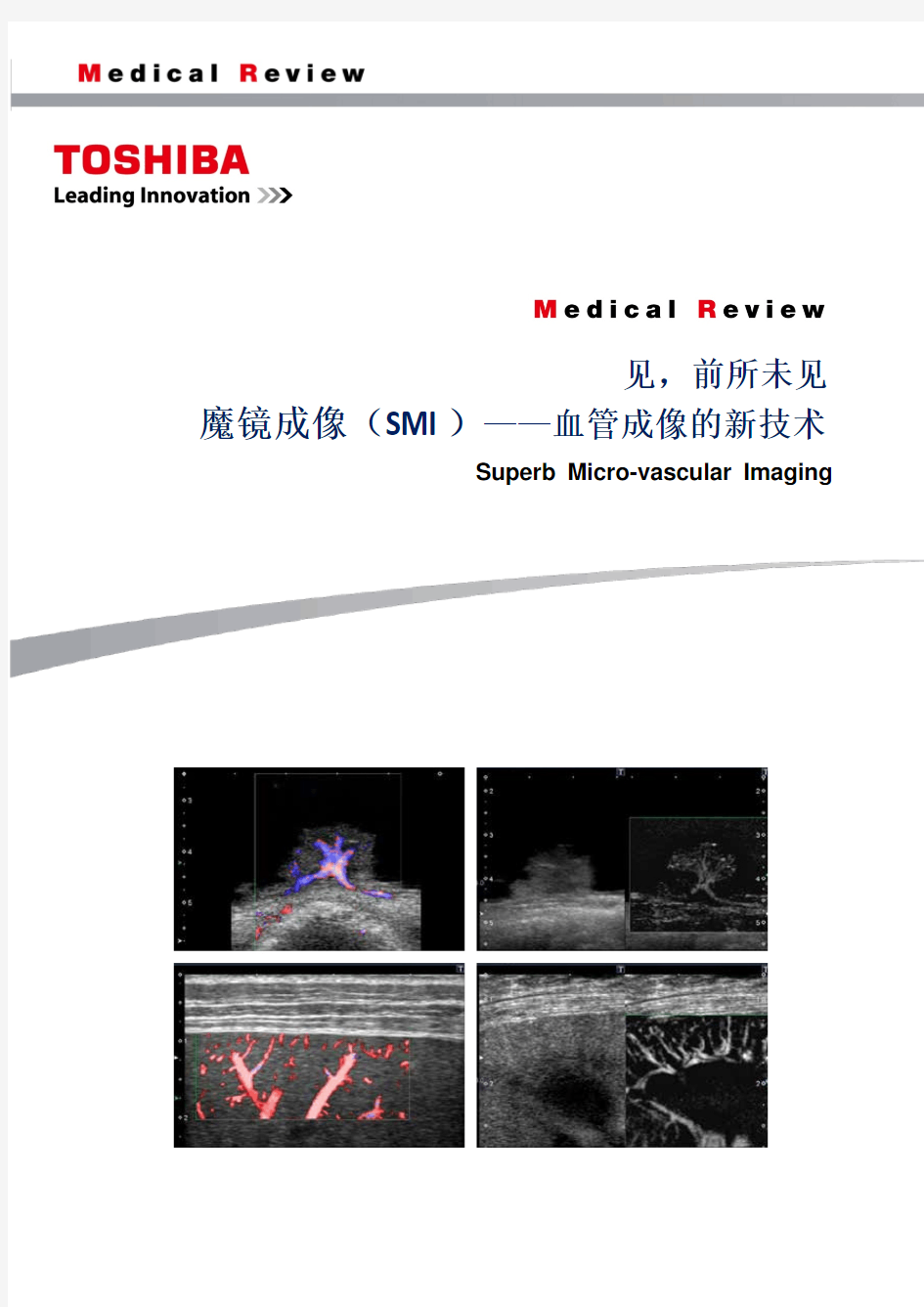 见,前所未见 魔镜成像(SMI)——血管成像的新技术