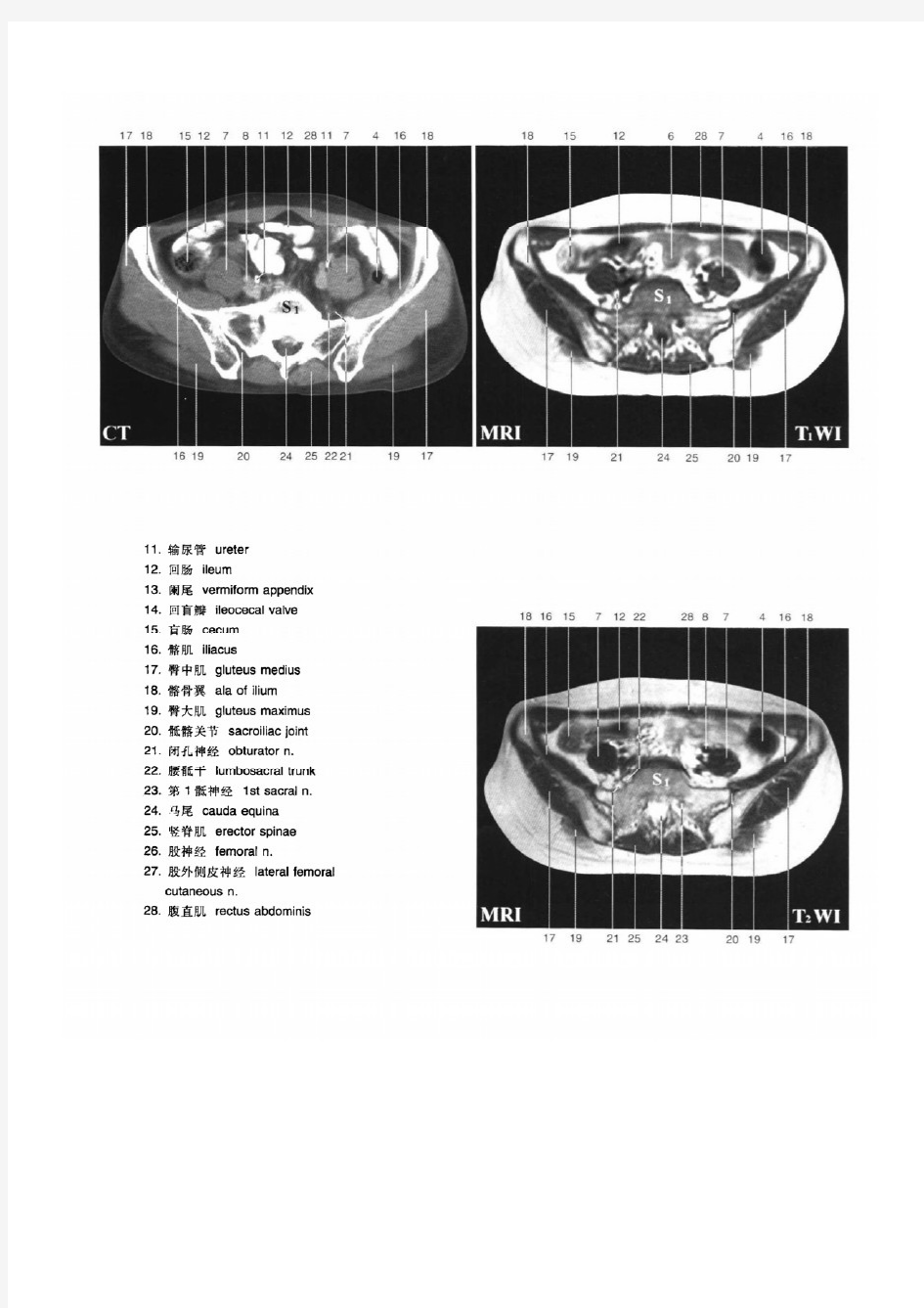 女性盆腔断层解剖彩色图谱