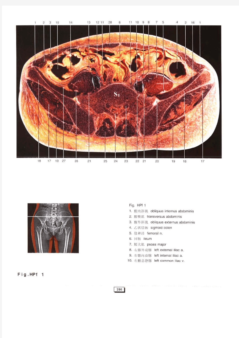 女性盆腔断层解剖彩色图谱
