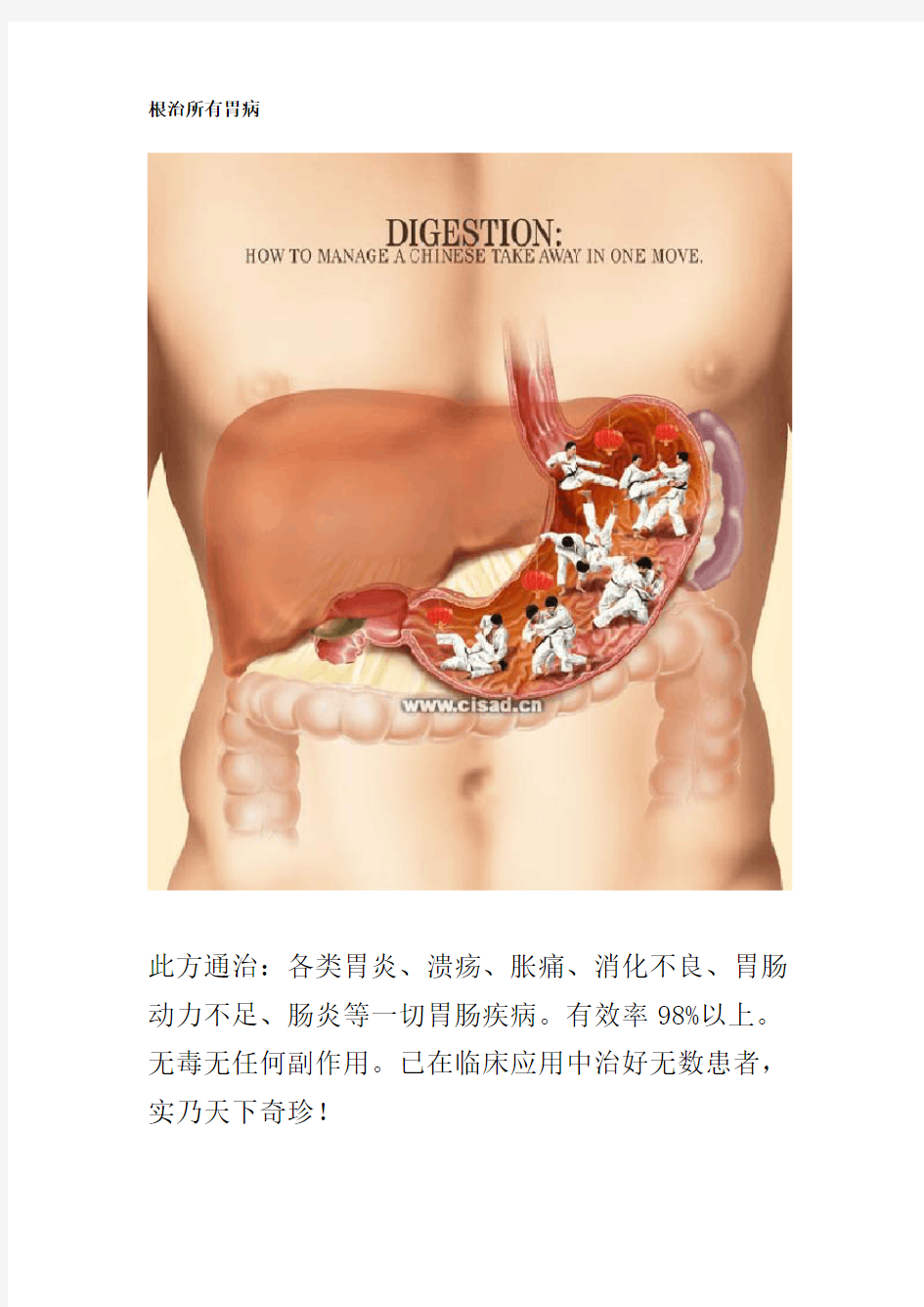 根治所有胃病