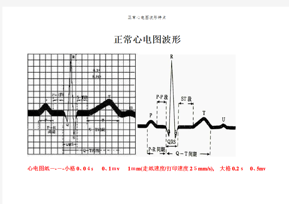 正常心电图波形特点