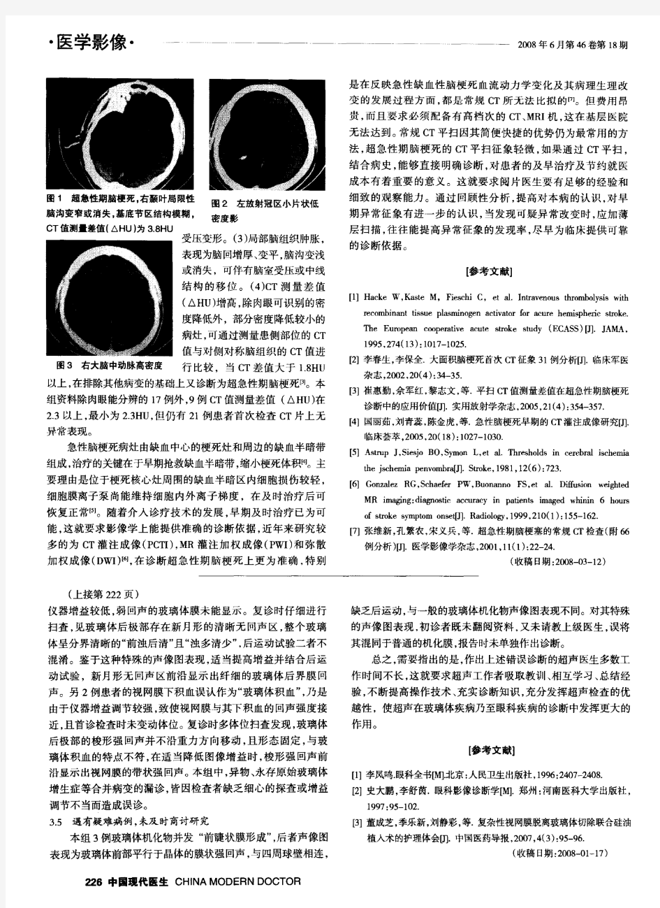 常规CT检查在超急性期脑梗死诊断中的应用