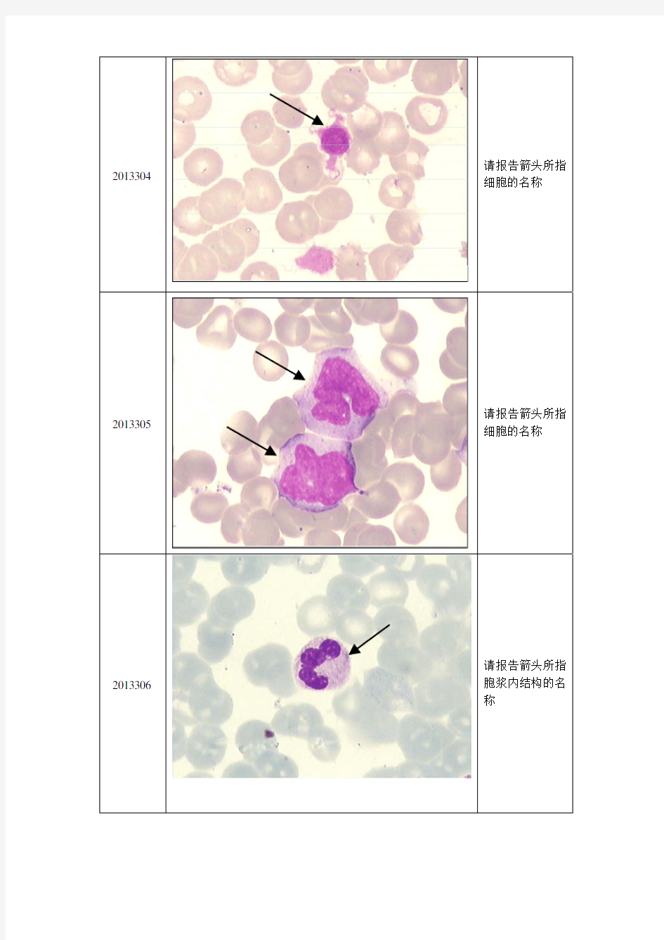 2013年第3次血细胞形态学检查室间质评及答案