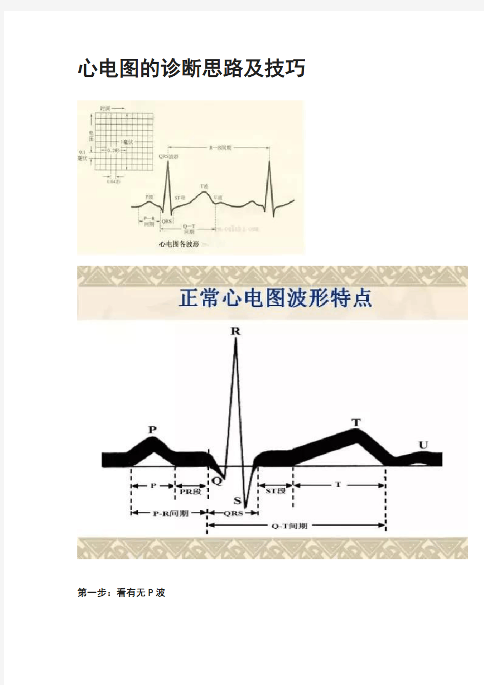 常见疾病心电图诊断技巧