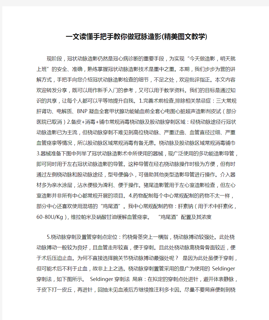 一文读懂手把手教你做冠脉造影(精美图文教学)