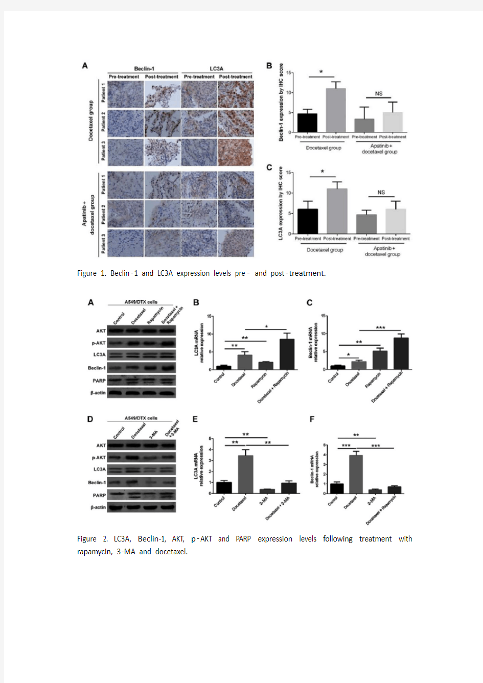 阿帕替尼通过调节自噬作用使化学耐药的NSCLC细胞对多西他赛敏感