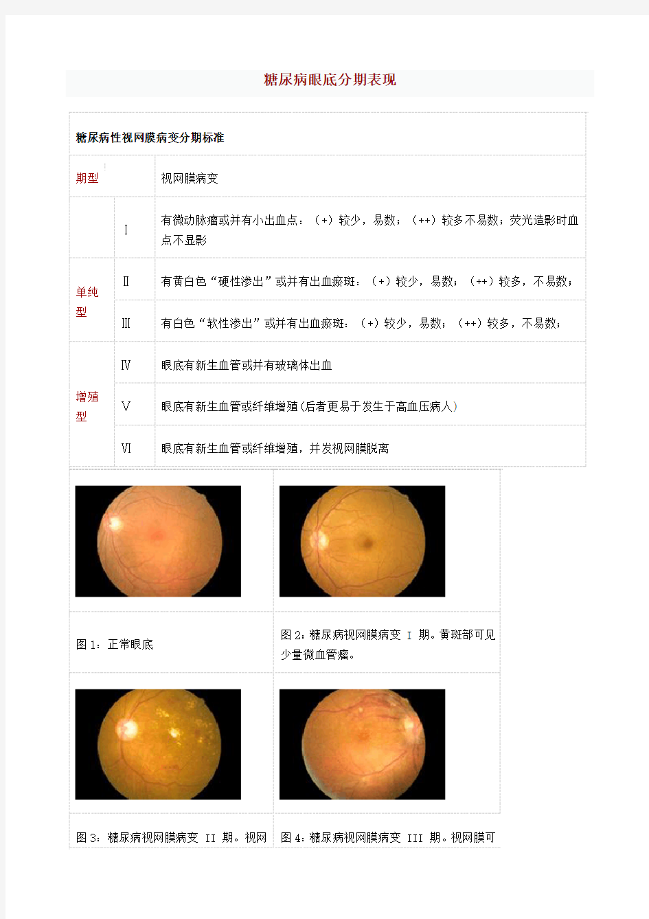 糖尿病眼底分期表现