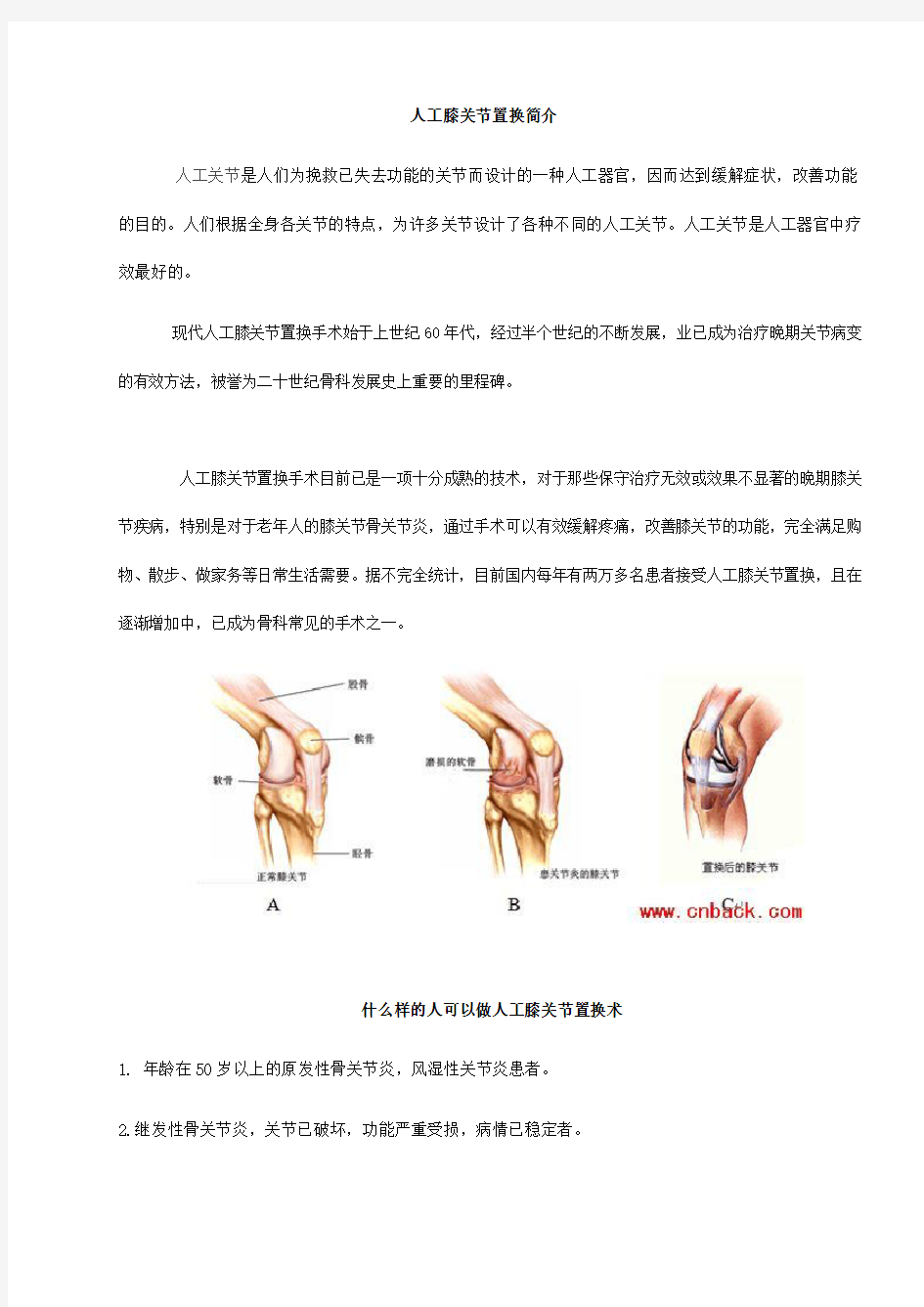 人工膝关节置换手术步骤