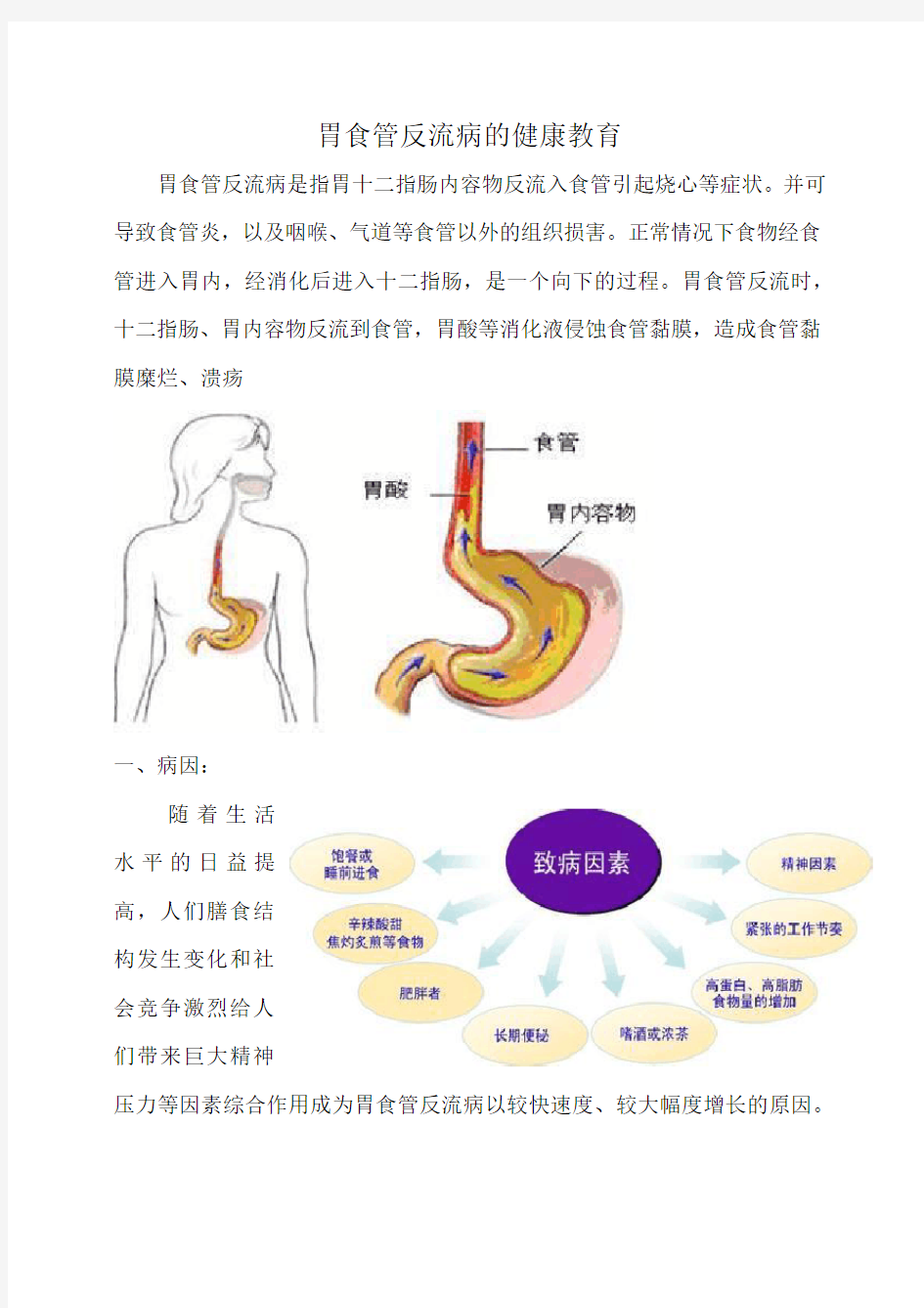 胃食管反流病的健康教育