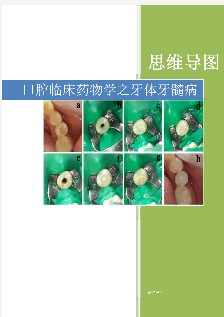 口腔临床药物学之牙体牙髓病思维导图