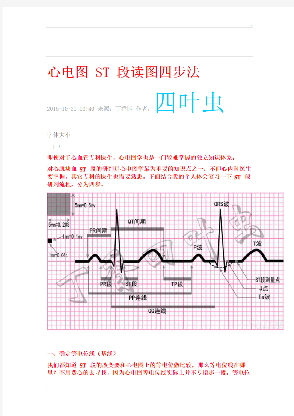 心电图ST段读图四步法 (1)