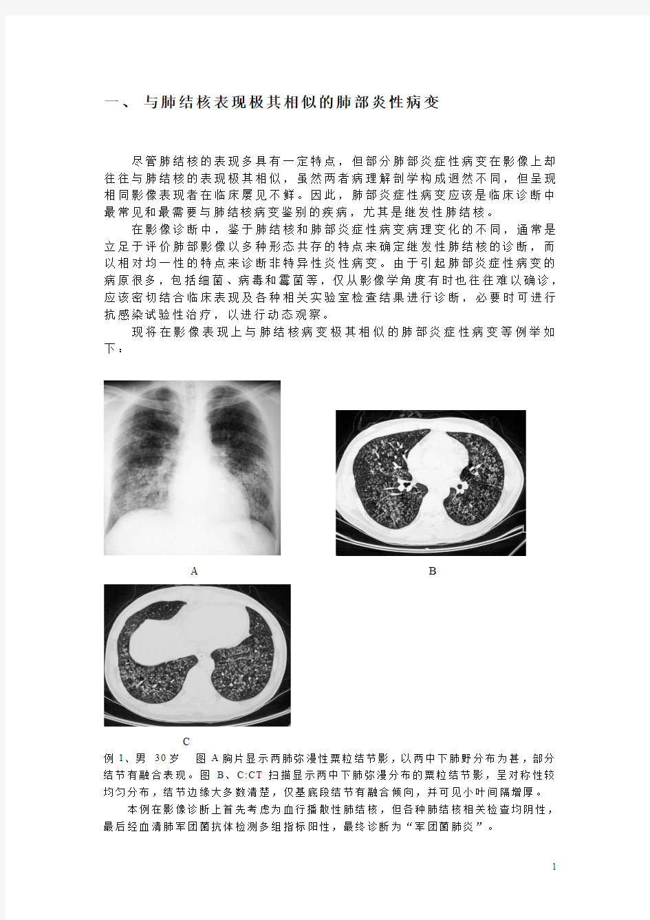 肺结核不典型影像学表现的分析与诊断