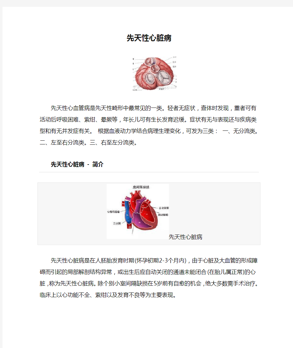 先天性心脏病基本知识